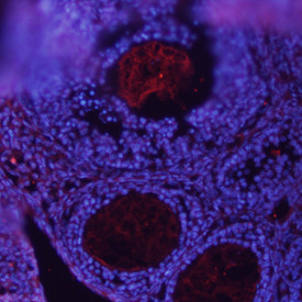 BMP-15 Antibody in Immunohistochemistry (Frozen) (IHC (F))