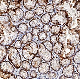 S100P Antibody in Immunohistochemistry (Paraffin) (IHC (P))