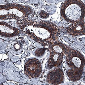 ICAT Antibody in Immunohistochemistry (Paraffin) (IHC (P))