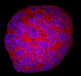 EphA1 Antibody in Immunocytochemistry (ICC/IF)