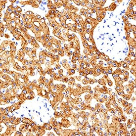 TFR2 Antibody in Immunohistochemistry (Paraffin) (IHC (P))