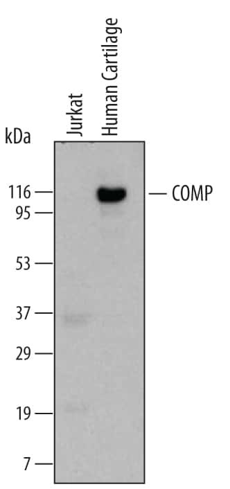 COMP Antibody in Western Blot (WB)