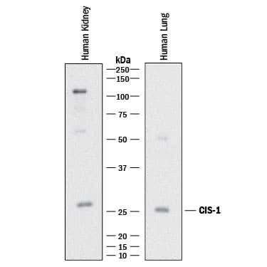 CIS Antibody in Western Blot (WB)