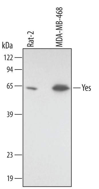 YES1 Antibody in Western Blot (WB)