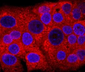 FGR Antibody in Immunocytochemistry (ICC/IF)