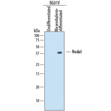 Nodal Antibody in Western Blot (WB)