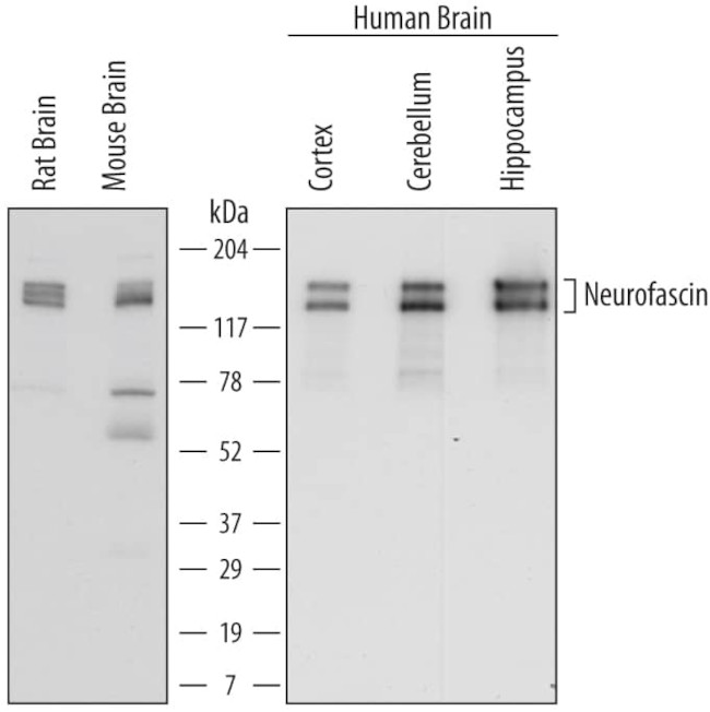 Neurofascin Antibody in Western Blot (WB)