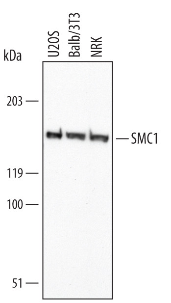 SMC1 Antibody in Western Blot (WB)