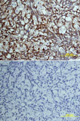 Factor VII Antibody in Immunohistochemistry (Frozen) (IHC (F))