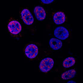 HES1 Antibody in Immunocytochemistry (ICC/IF)