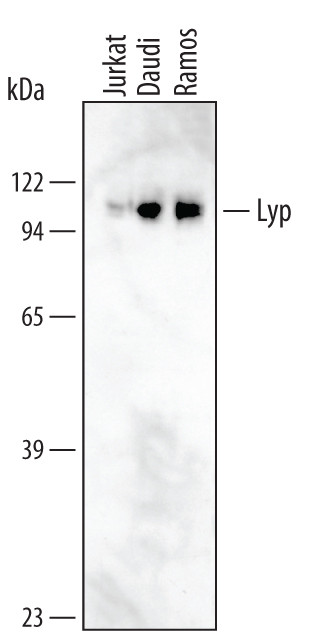 PTPN22 Antibody in Western Blot (WB)