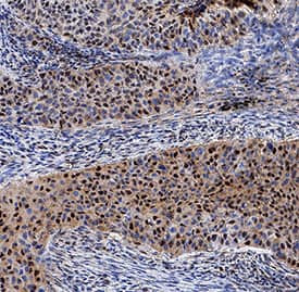 GLI2 Antibody in Immunohistochemistry (Paraffin) (IHC (P))