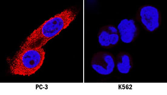 MKP3 Antibody in Immunocytochemistry (ICC/IF)