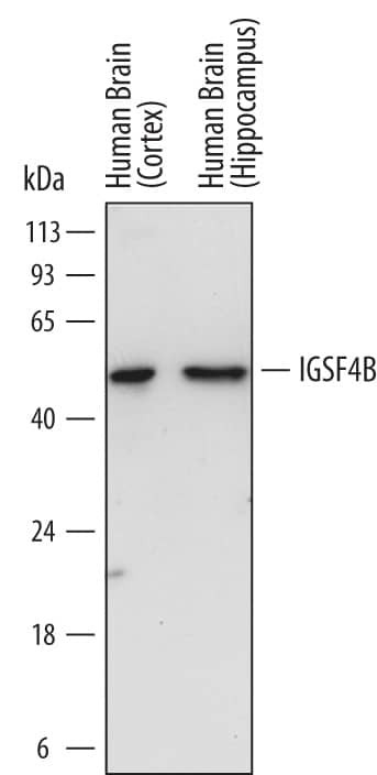 CADM3 Antibody in Western Blot (WB)