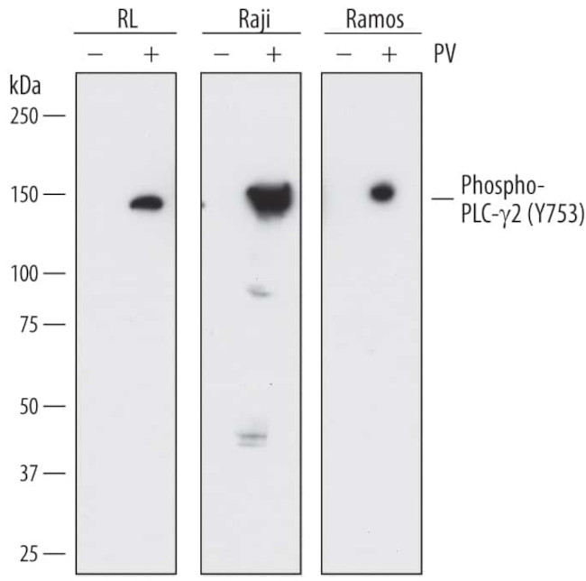 Phospho-PLCG2 (Tyr753) Antibody in Western Blot (WB)