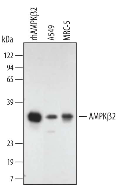 AMPK beta-2 Antibody in Western Blot (WB)