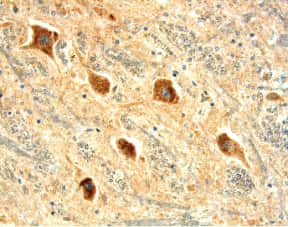 OPRK1 Antibody in Immunohistochemistry (Paraffin) (IHC (P))