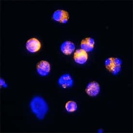 CD160 Antibody in Immunocytochemistry (ICC/IF)