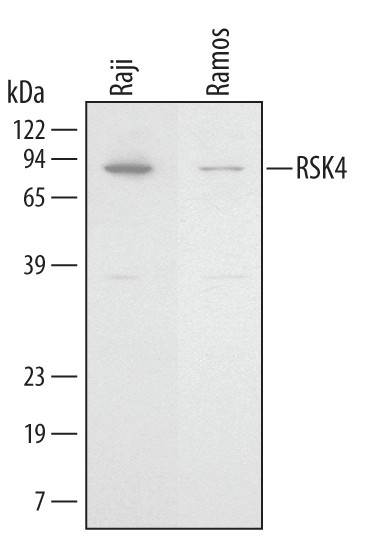 RSK4 Antibody in Western Blot (WB)