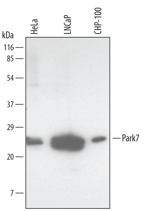 DJ-1 Antibody in Western Blot (WB)