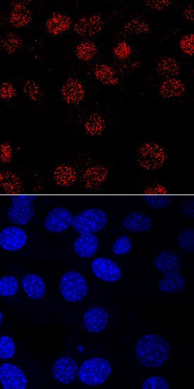 MYF5 Antibody in Immunocytochemistry (ICC/IF)