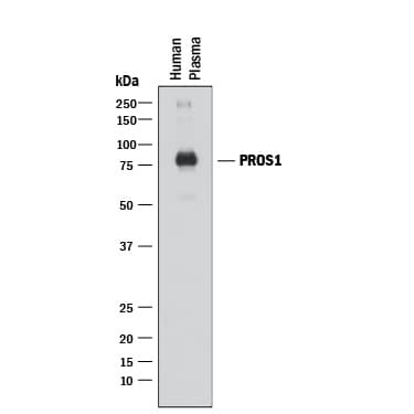 Protein S Antibody in Western Blot (WB)