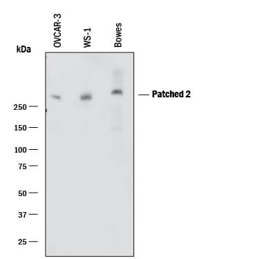 PTCH2 Antibody in Western Blot (WB)