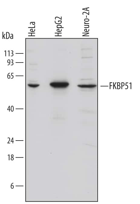 FKBP5 Antibody in Western Blot (WB)