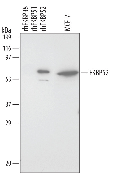 FKBP4 Antibody in Western Blot (WB)
