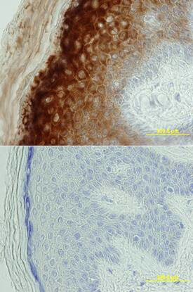 BACE2 Antibody in Immunohistochemistry (Paraffin) (IHC (P))