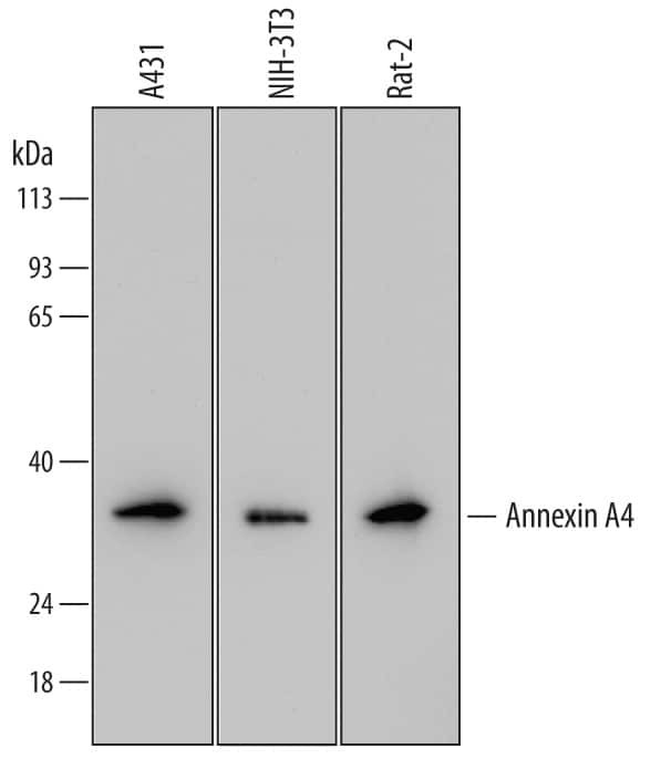 Annexin A4 Antibody in Western Blot (WB)