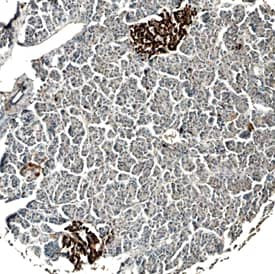 SERPINB8 Antibody in Immunohistochemistry (Paraffin) (IHC (P))