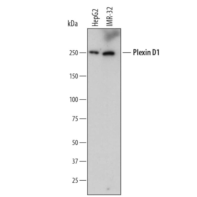 PLXND1 Antibody in Western Blot (WB)
