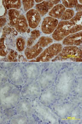 CADM4 Antibody in Immunohistochemistry (Paraffin) (IHC (P))
