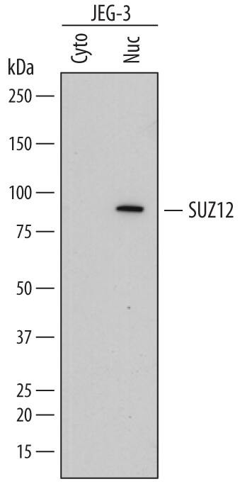 SUZ12 Antibody in Western Blot (WB)