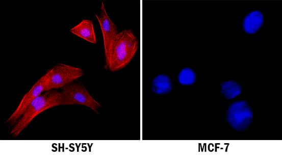 ALK Antibody in Immunocytochemistry (ICC/IF)