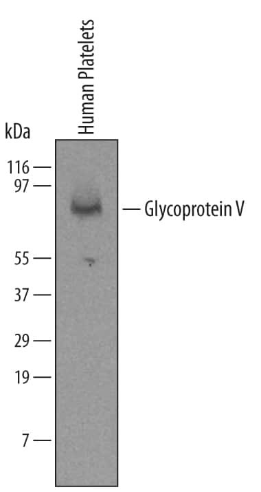 CD42d Antibody in Western Blot (WB)