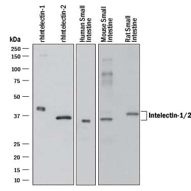 ITLN1/ITLN2 Antibody in Western Blot (WB)