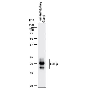 FSH beta Antibody in Western Blot (WB)