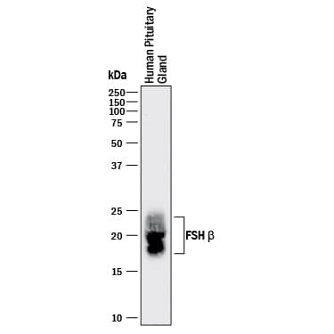 FSH beta Antibody in Western Blot (WB)
