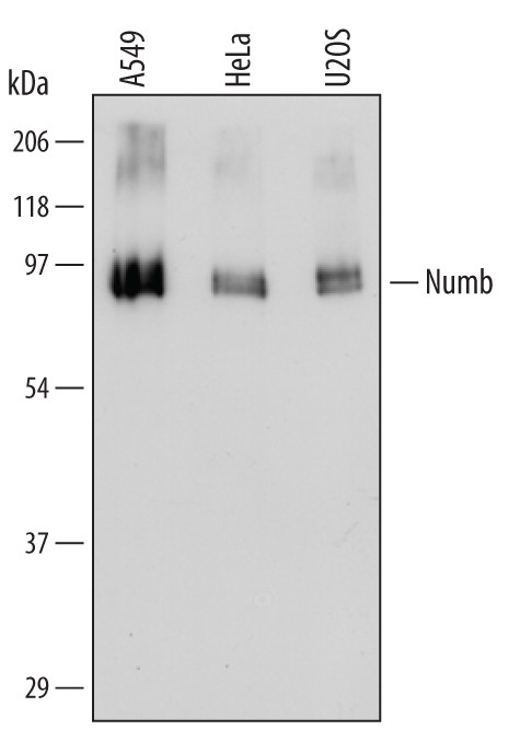 NUMB Antibody in Western Blot (WB)