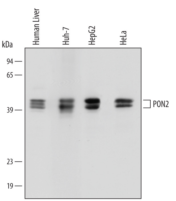 PON2 Antibody in Western Blot (WB)