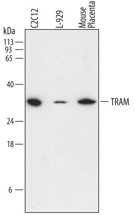 TICAM2 Antibody in Western Blot (WB)