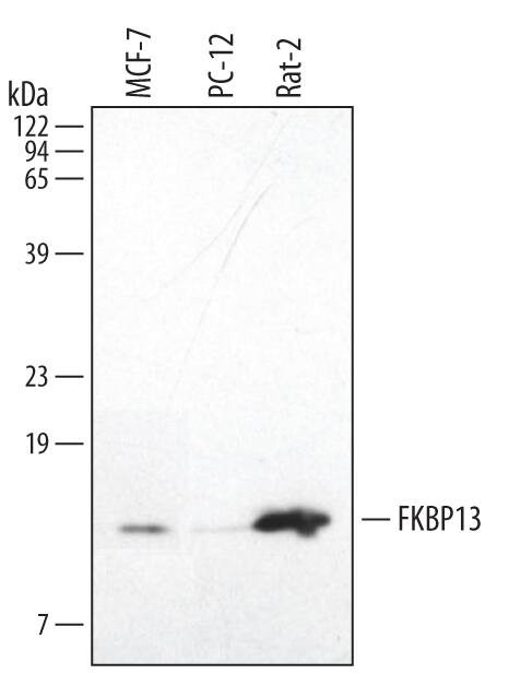 FKBP2 Antibody in Western Blot (WB)