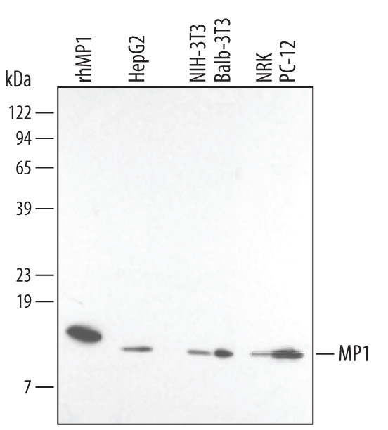 LAMTOR3 Antibody in Western Blot (WB)