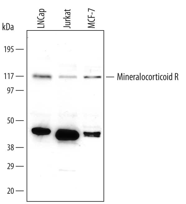 NR3C2 Antibody in Western Blot (WB)