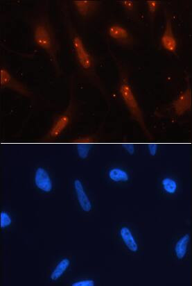 TCF3 Antibody in Immunocytochemistry (ICC/IF)