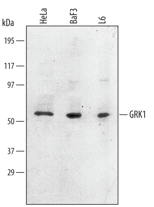 GRK1 Antibody in Western Blot (WB)