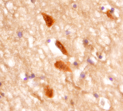 mGluR5 Antibody in Immunohistochemistry (Paraffin) (IHC (P))