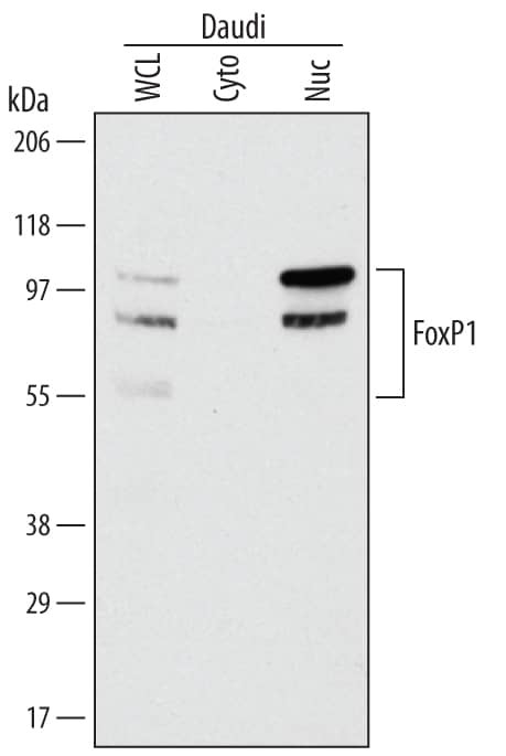 FOXP1 Antibody in Western Blot (WB)